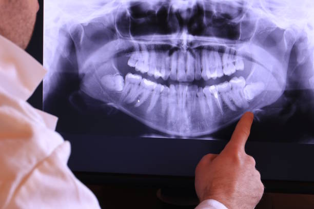 Best Emergency Broken Tooth Repair in Claypool Hill, VA